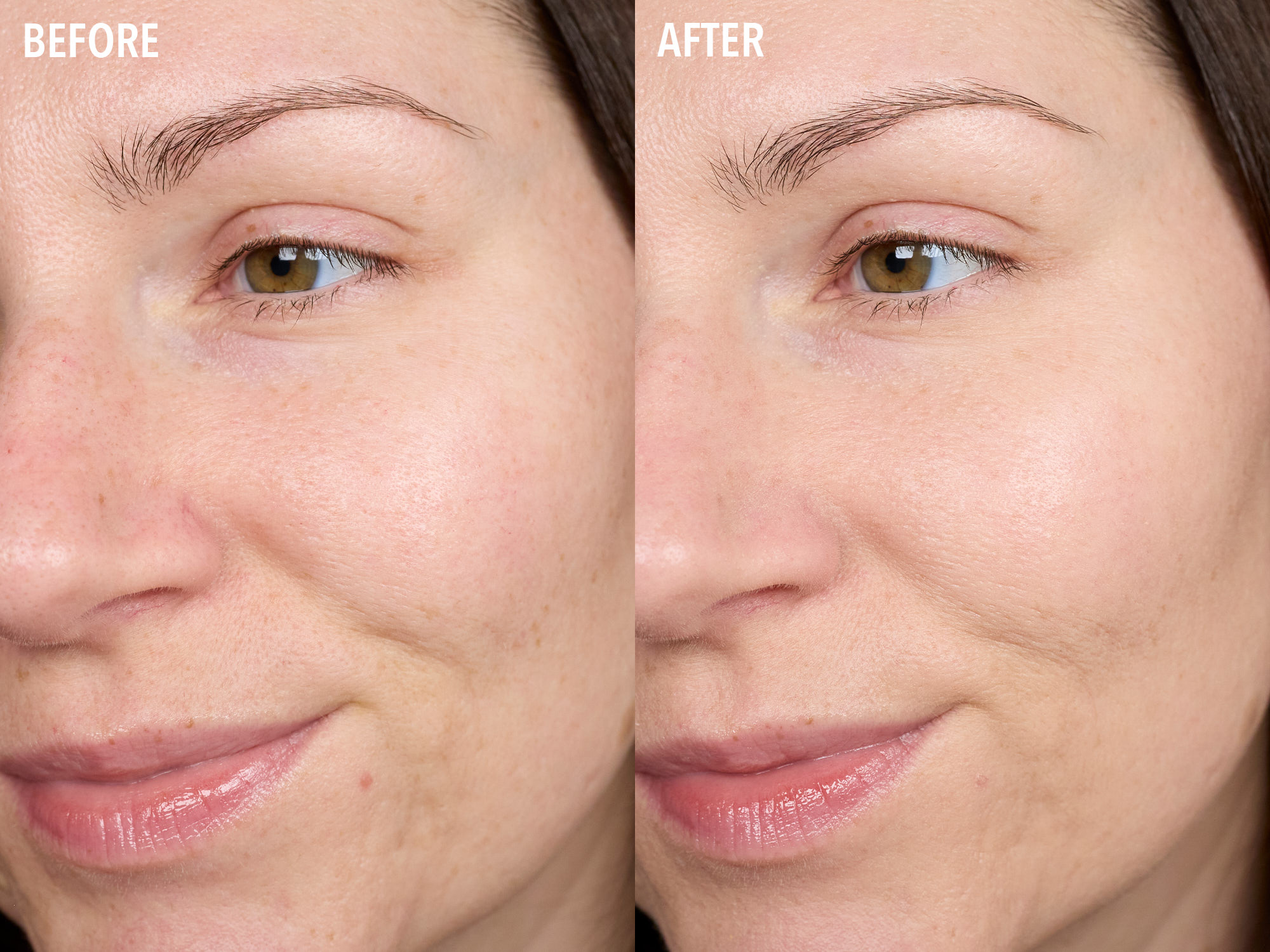 Before & After | It Cosmetics Do It All Sheer Tint Face Balm